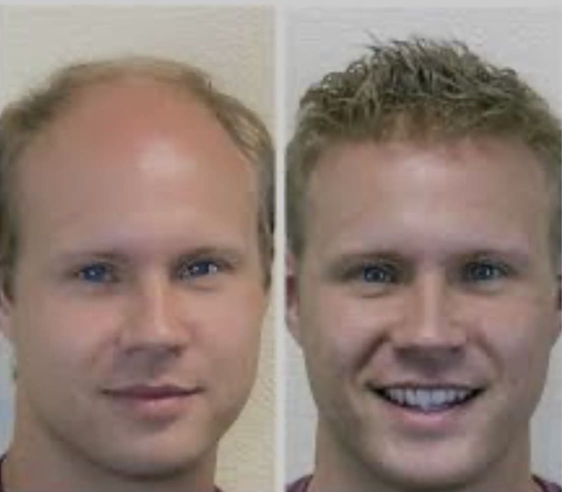 Two men with different hair colors and their faces.